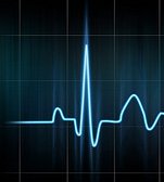 ECG